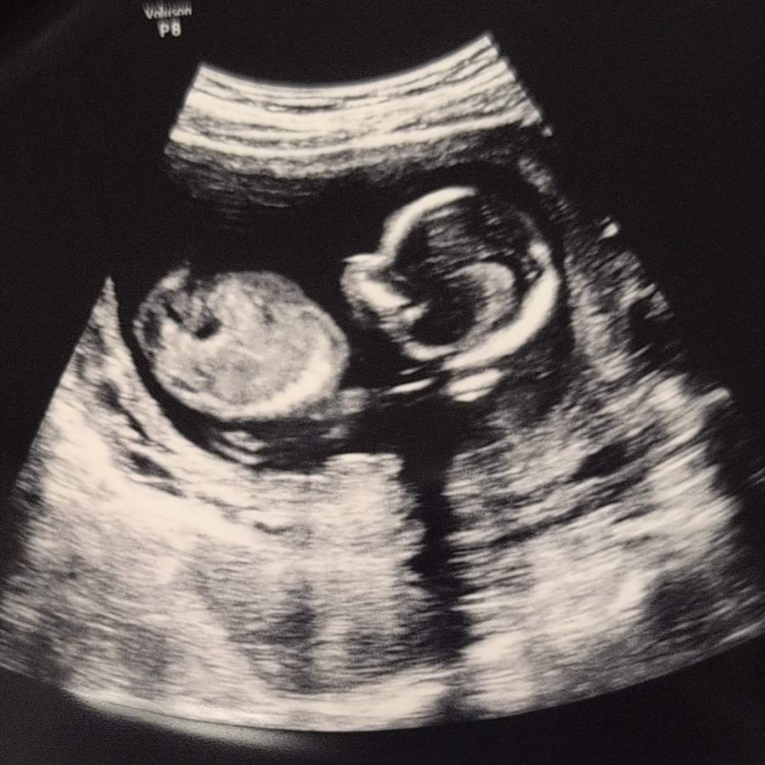 Photo shared by Jessica for their Babylist baby registry.