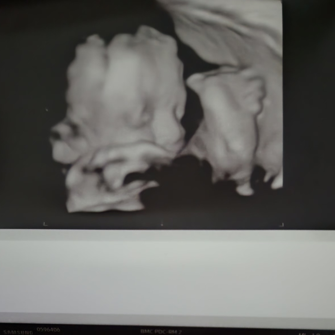 Photo shared by Desiree for their Babylist baby registry.