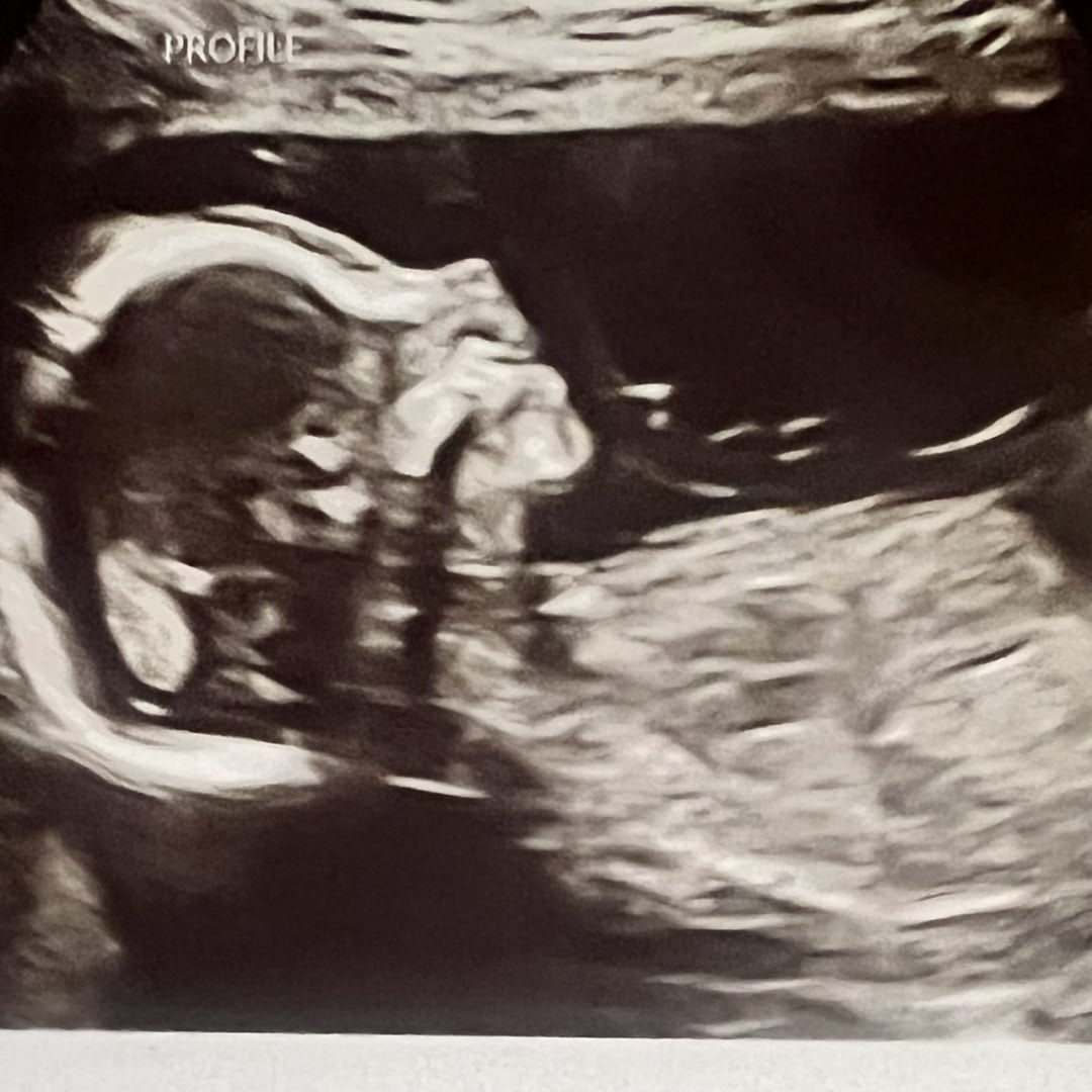 Photo shared by Lauren for their Babylist baby registry.