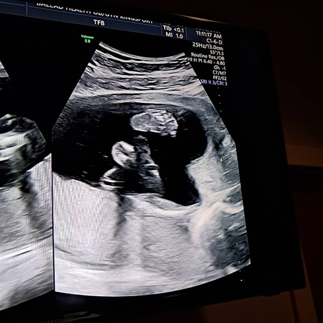 Photo shared by Liliana for their Babylist baby registry.