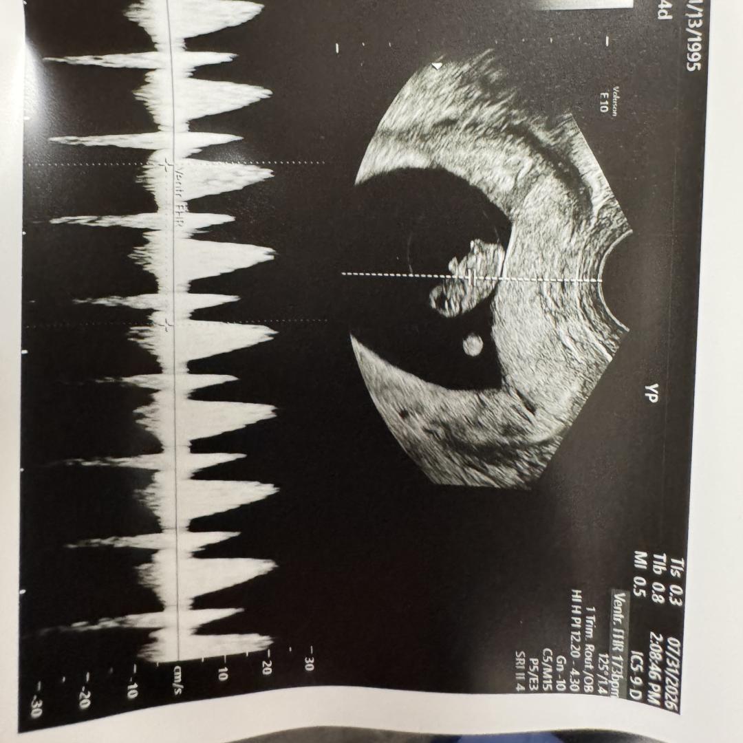 Photo shared by Corey for their Babylist baby registry.