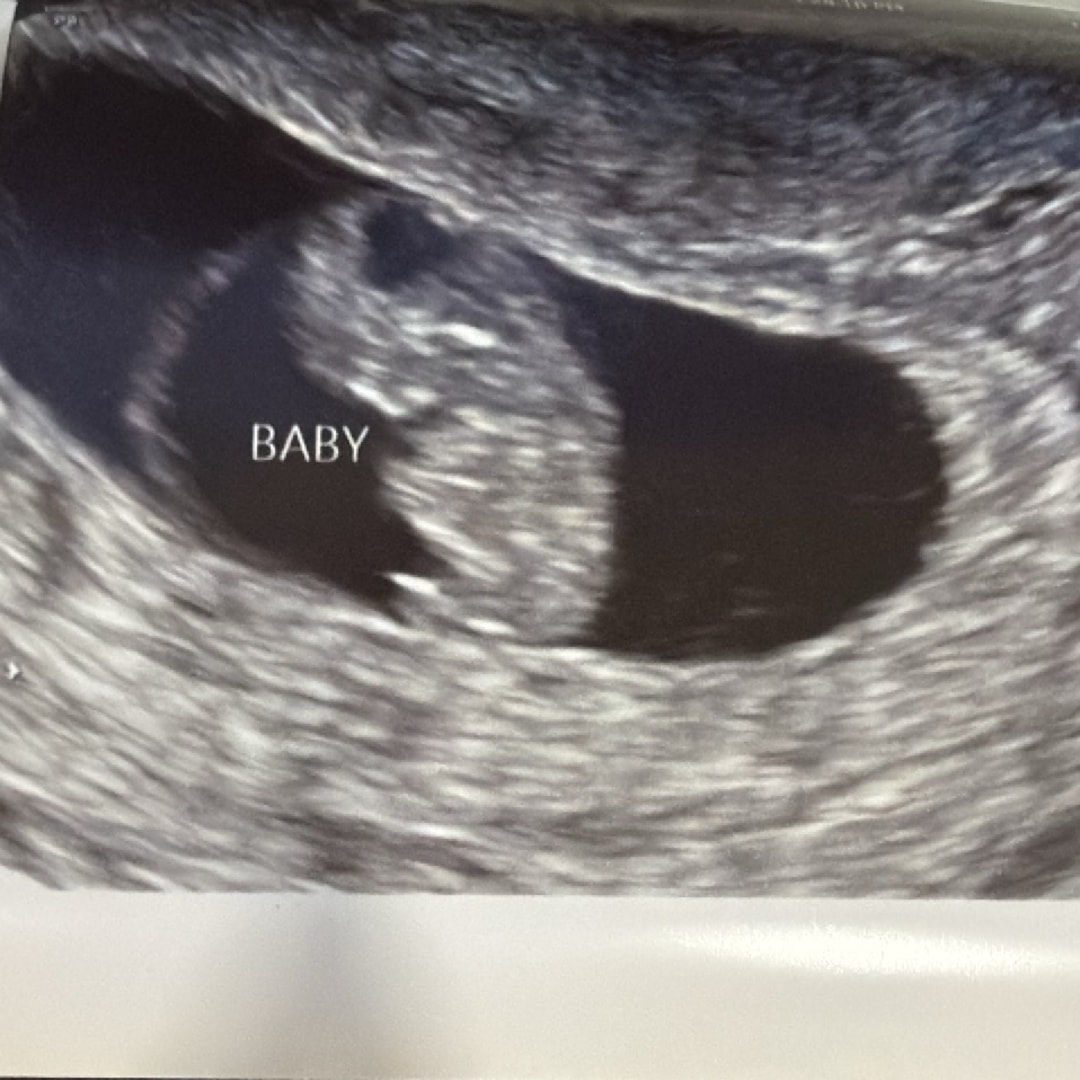 Photo shared by Alexis for their Babylist baby registry.