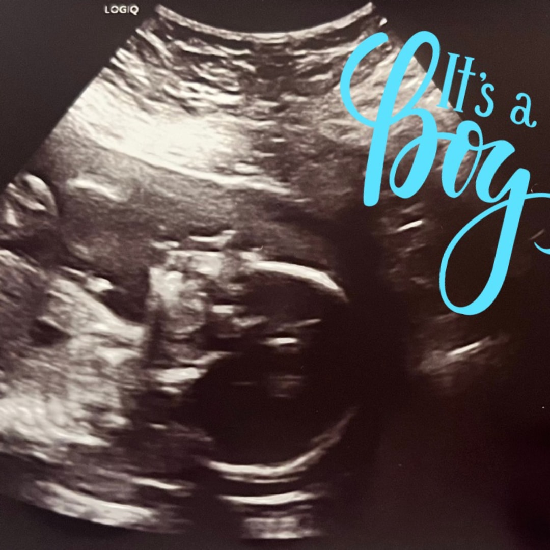 Photo shared by Natalie for their Babylist baby registry.