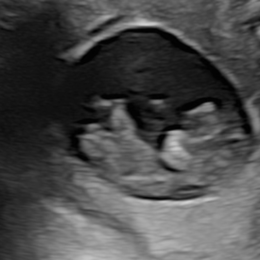 Photo shared by Lee for their Babylist baby registry.