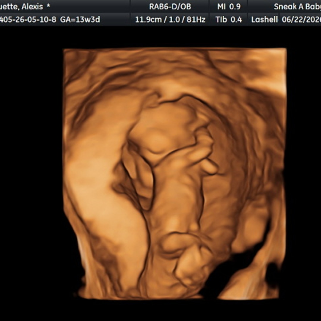 Photo shared by Alexis for their Babylist baby registry.