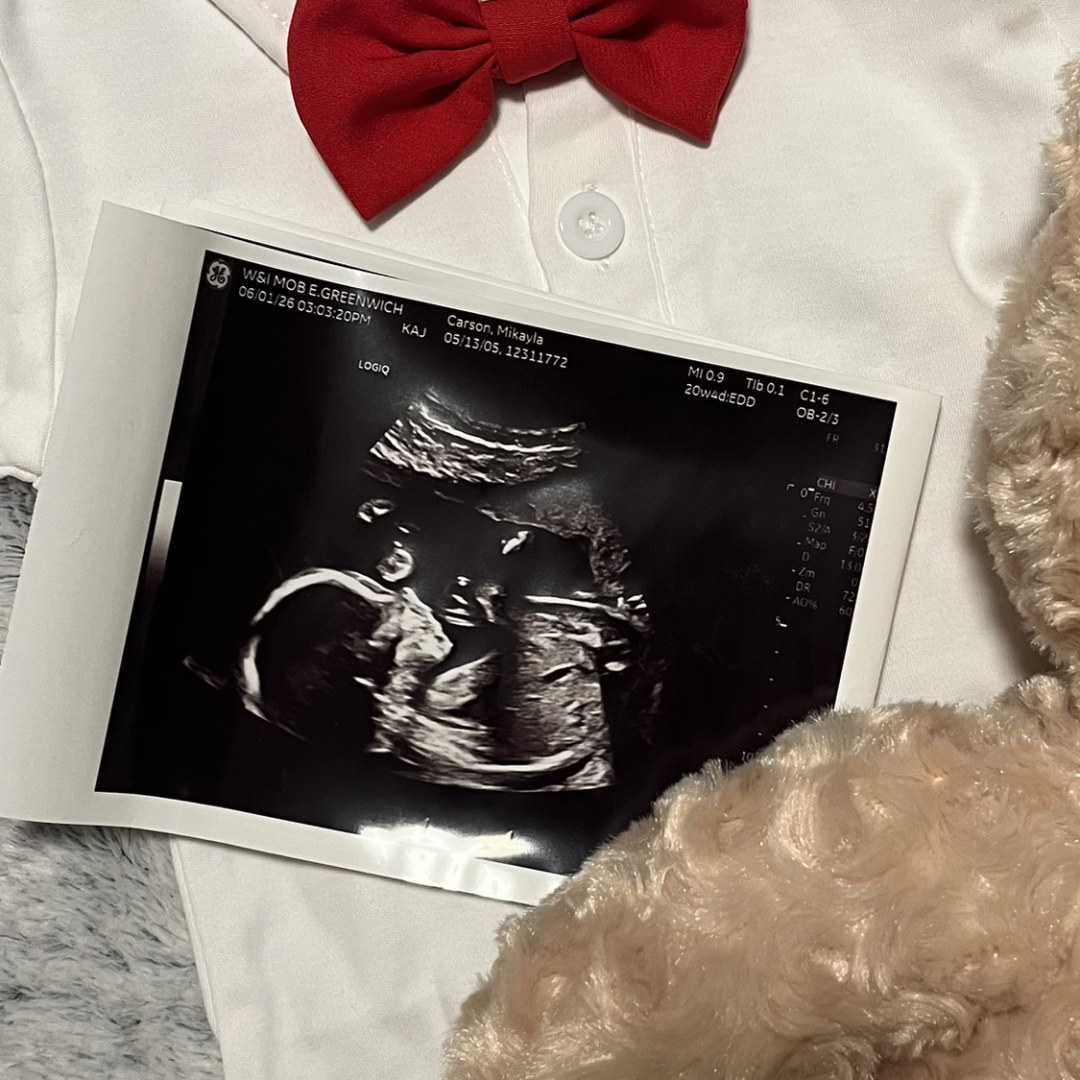 Photo shared by Mikayla for their Babylist baby registry.