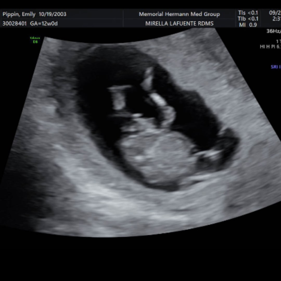 Photo shared by Emily for their Babylist baby registry.