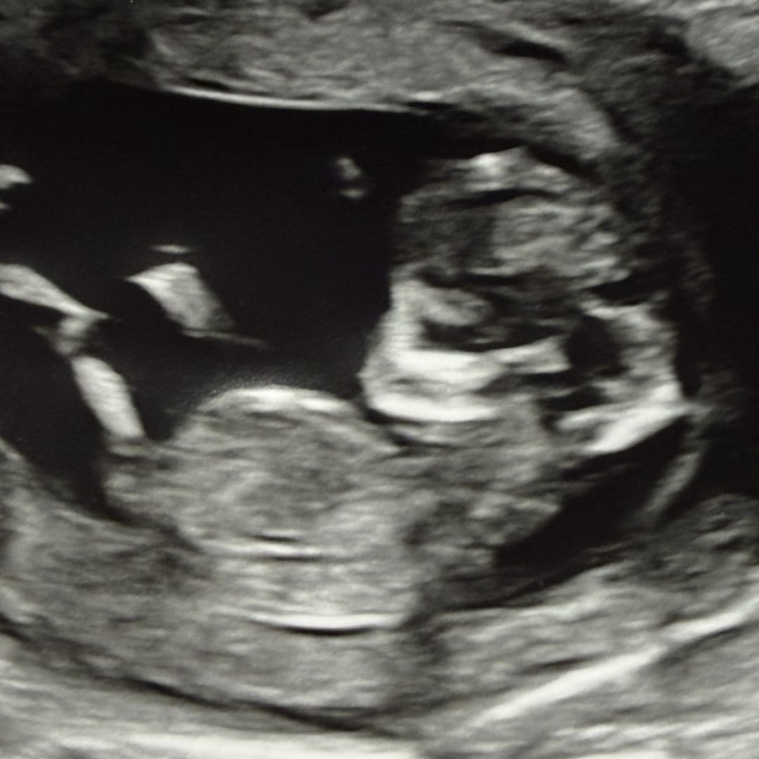 Photo shared by Kenlie for their Babylist baby registry.