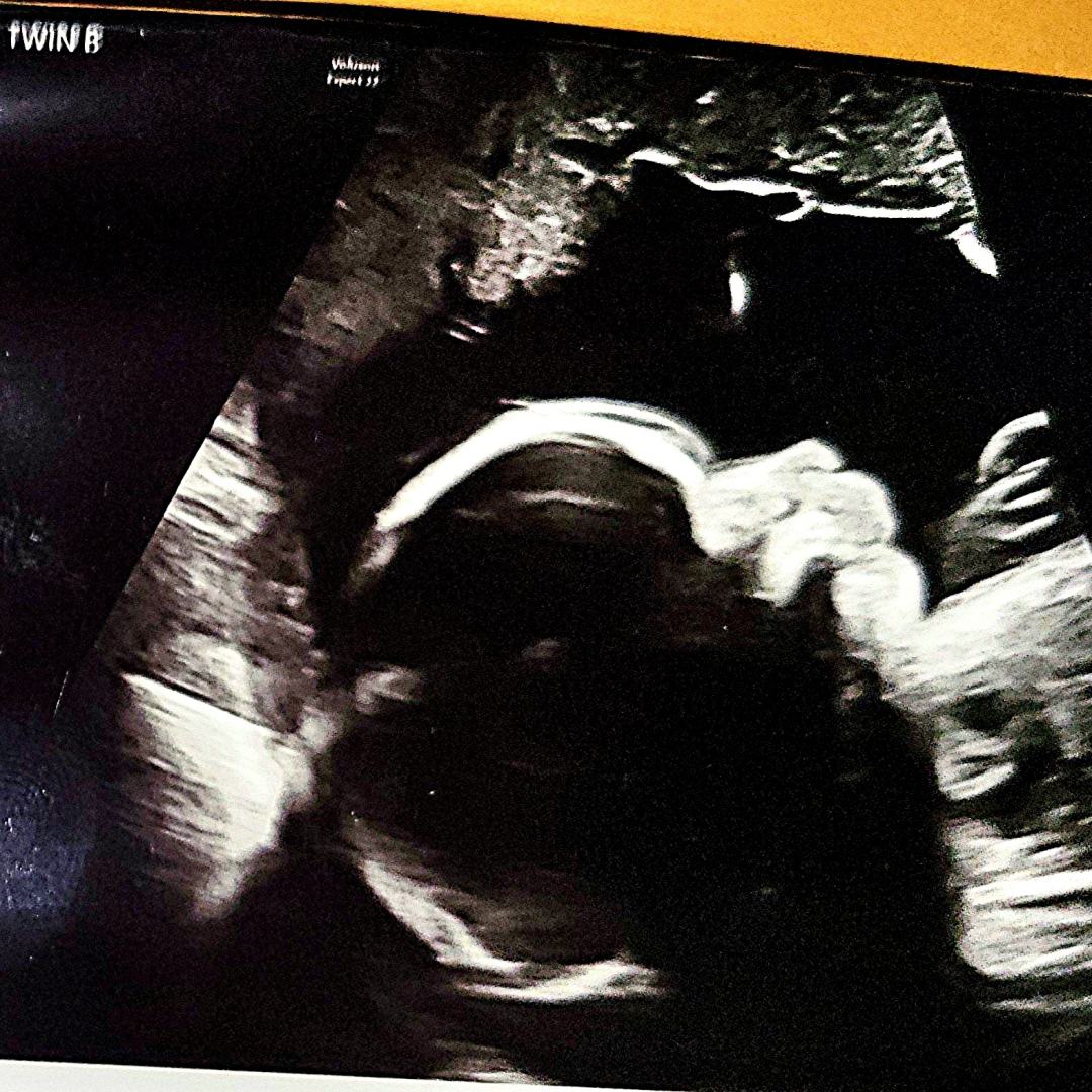 Photo shared by Jess for their Babylist baby registry.