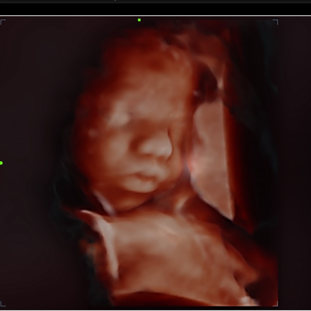 Photo shared by Alaina for their Babylist baby registry.