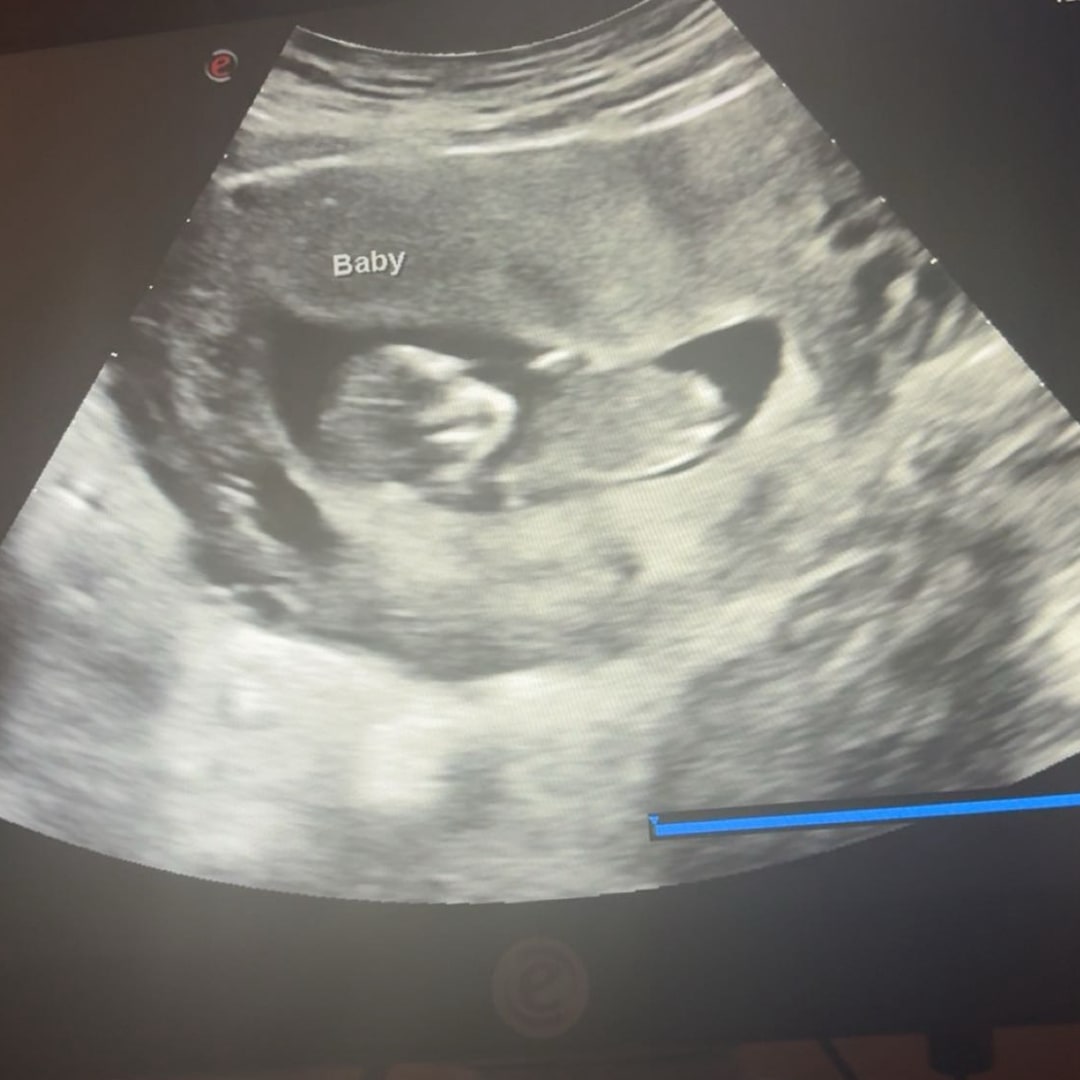 Photo shared by Jakaihya for their Babylist baby registry.