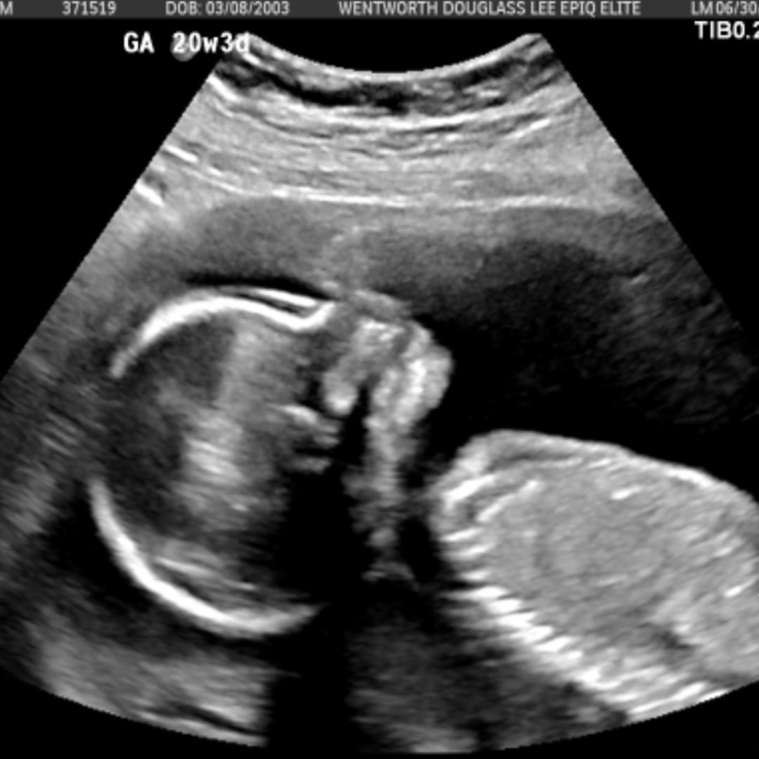 Photo shared by Dee for their Babylist baby registry.