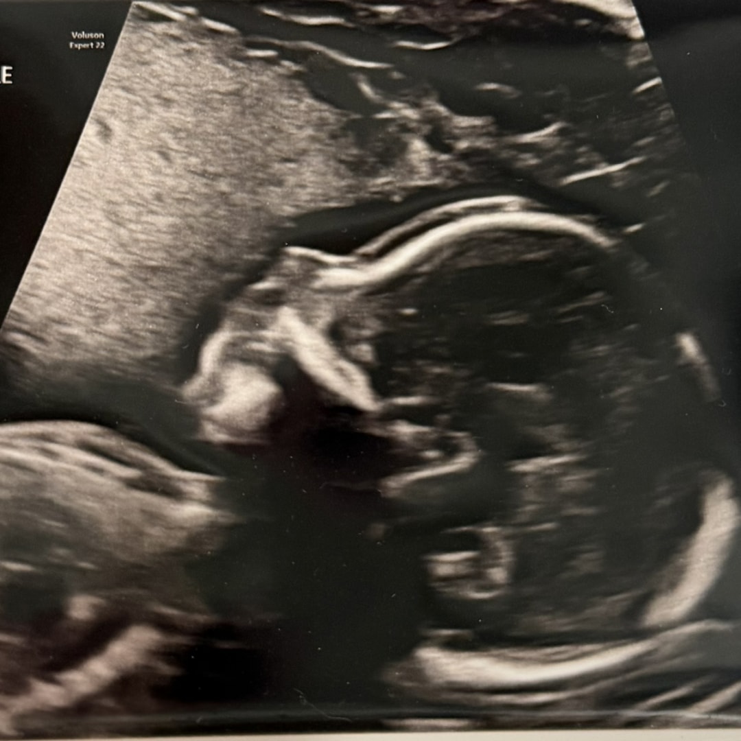 Photo shared by Allyson for their Babylist baby registry.