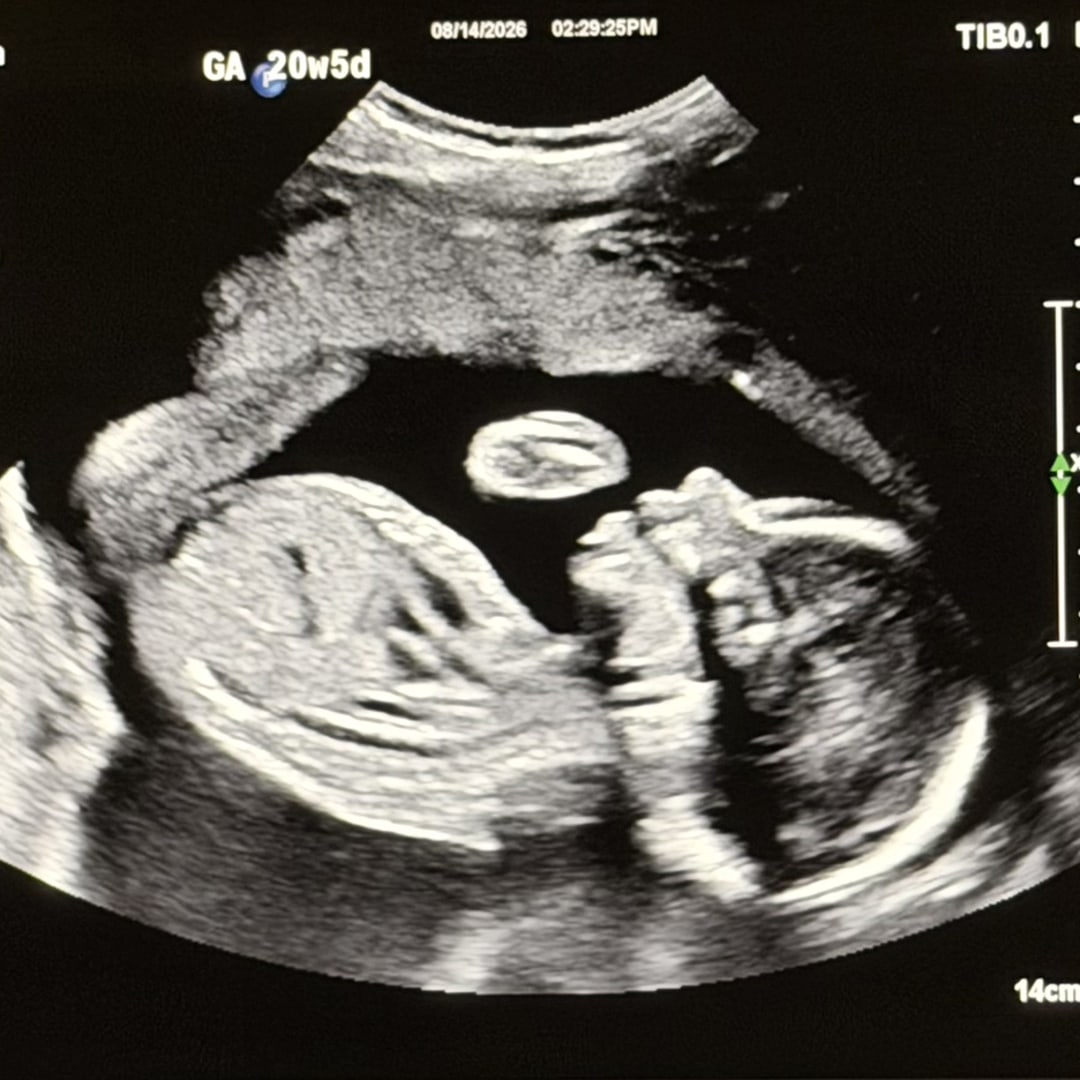 Photo shared by Izabella for their Babylist baby registry.