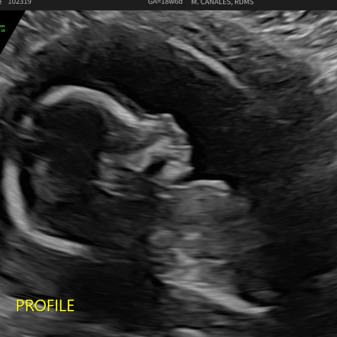 Photo shared by Trisha for their Babylist baby registry.