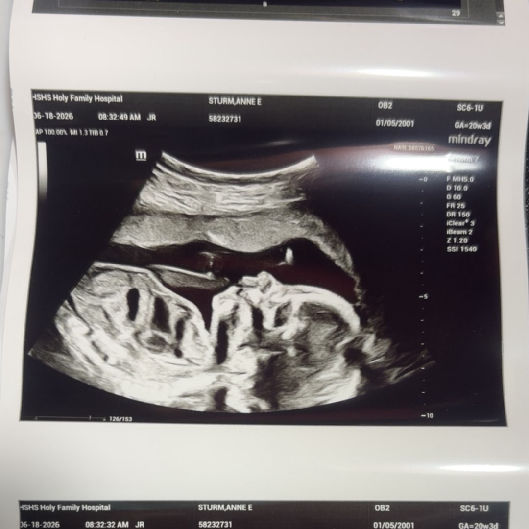Photo shared by Anne for their Babylist baby registry.
