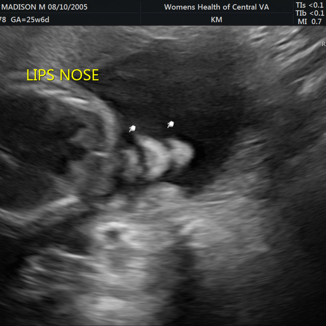 Photo shared by Maddie for their Babylist baby registry.