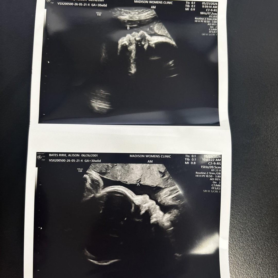 Photo shared by Alison for their Babylist baby registry.