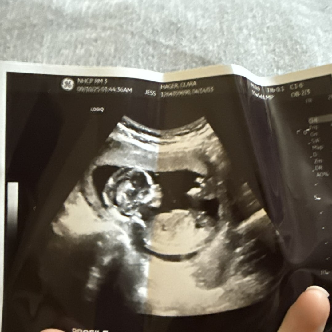 Photo shared by Clara for their Babylist baby registry.