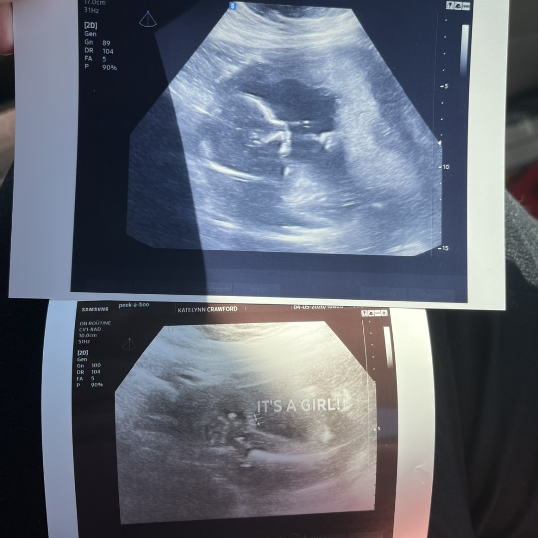 Photo shared by Katelynn for their Babylist baby registry.