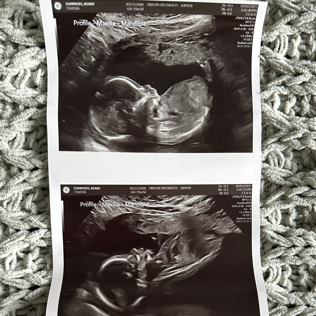 Photo shared by Kendi for their Babylist baby registry.