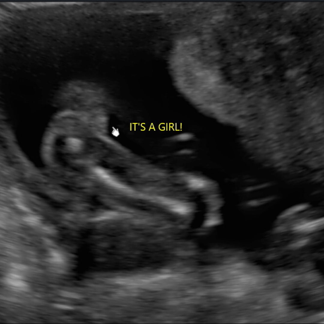 Photo shared by Amy for their Babylist baby registry.