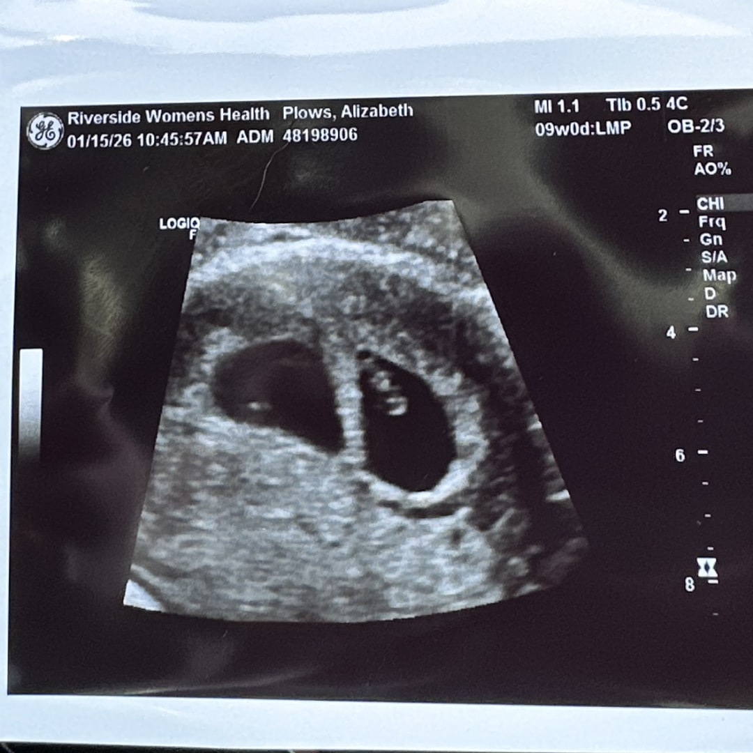 Photo shared by Alizabeth for their Babylist baby registry.