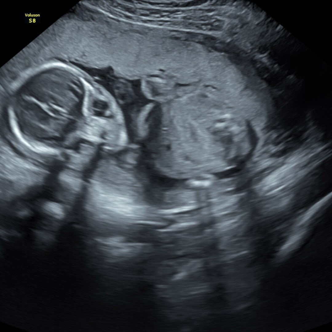 Photo shared by Abby for their Babylist baby registry.