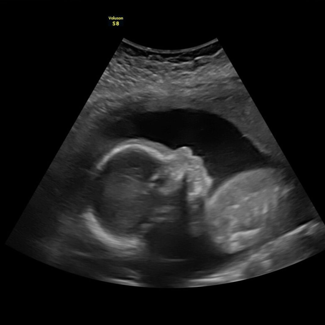 Photo shared by Macy for their Babylist baby registry.