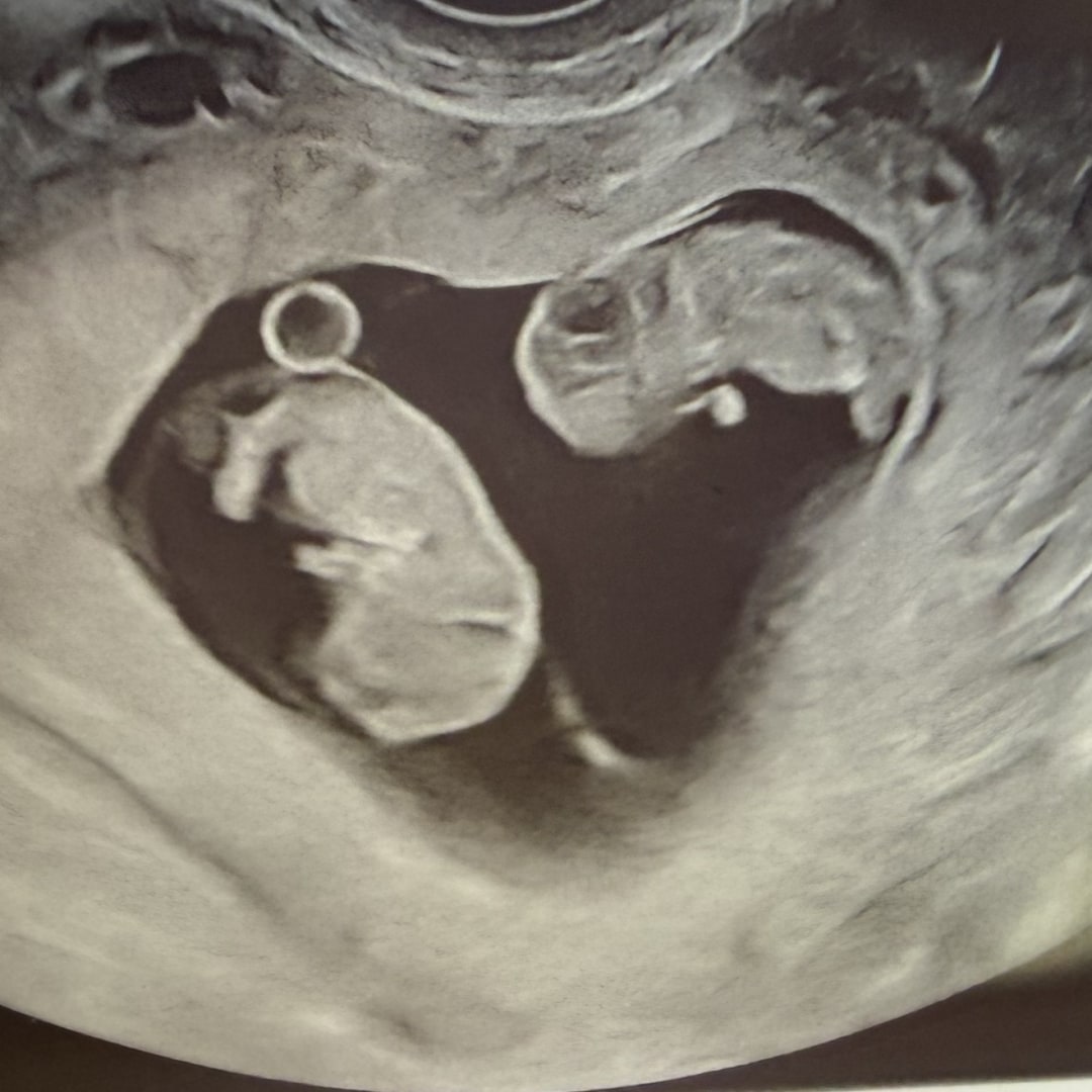 Photo shared by Chantelle for their Babylist baby registry.