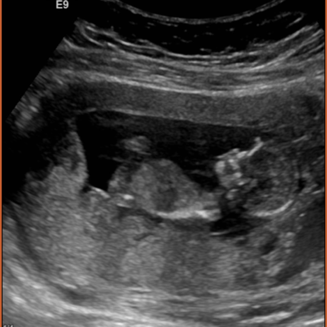 Photo shared by Elizabeth for their Babylist baby registry.