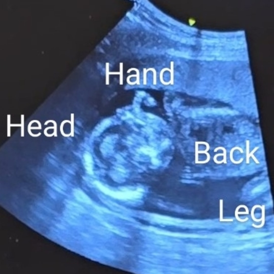 Photo shared by Amanda for their Babylist baby registry.