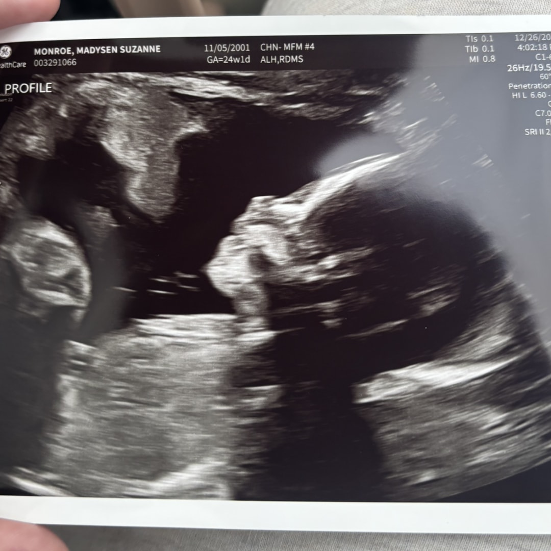 Photo shared by Madysen for their Babylist baby registry.