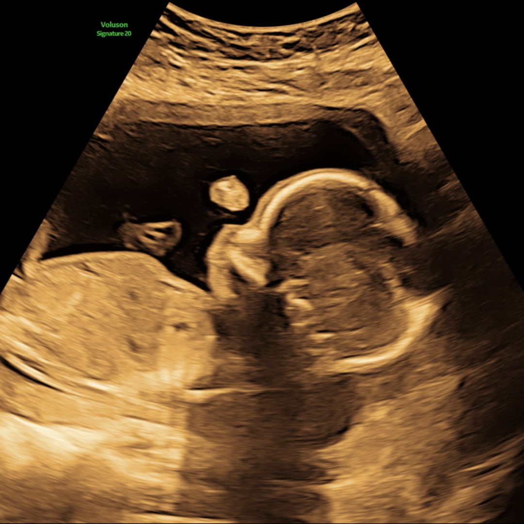 Photo shared by Katie for their Babylist baby registry.