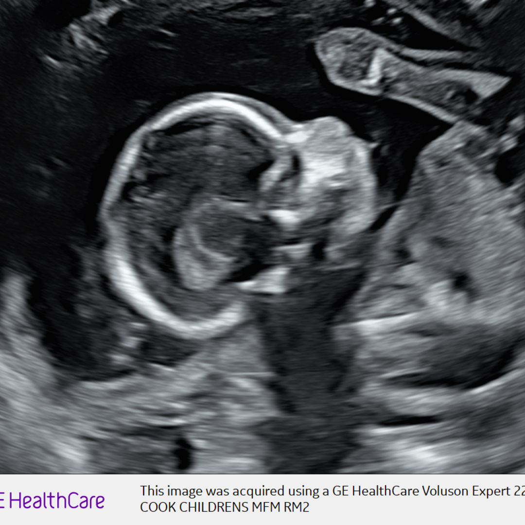 Photo shared by Markia for their Babylist baby registry.