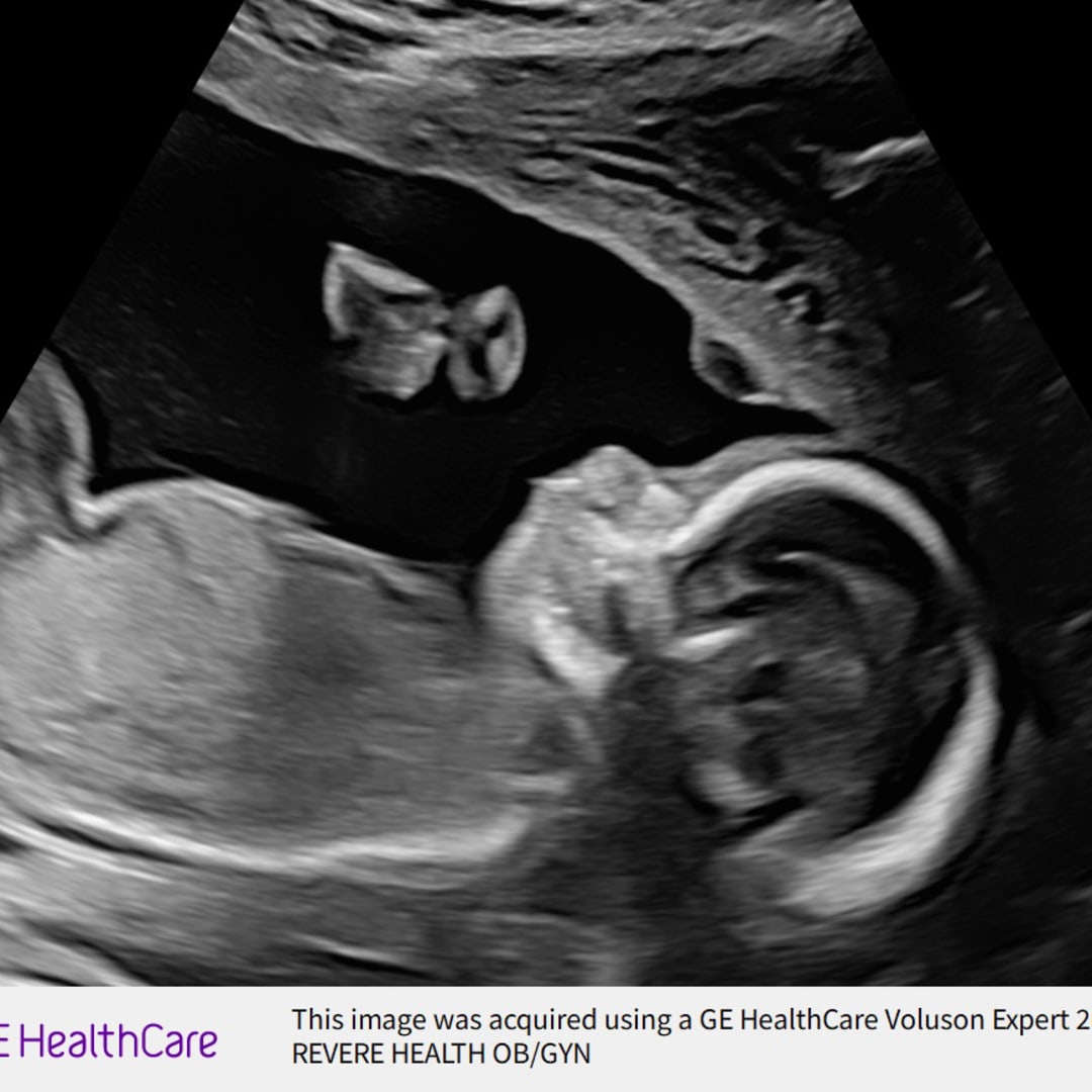 Photo shared by Maya for their Babylist baby registry.