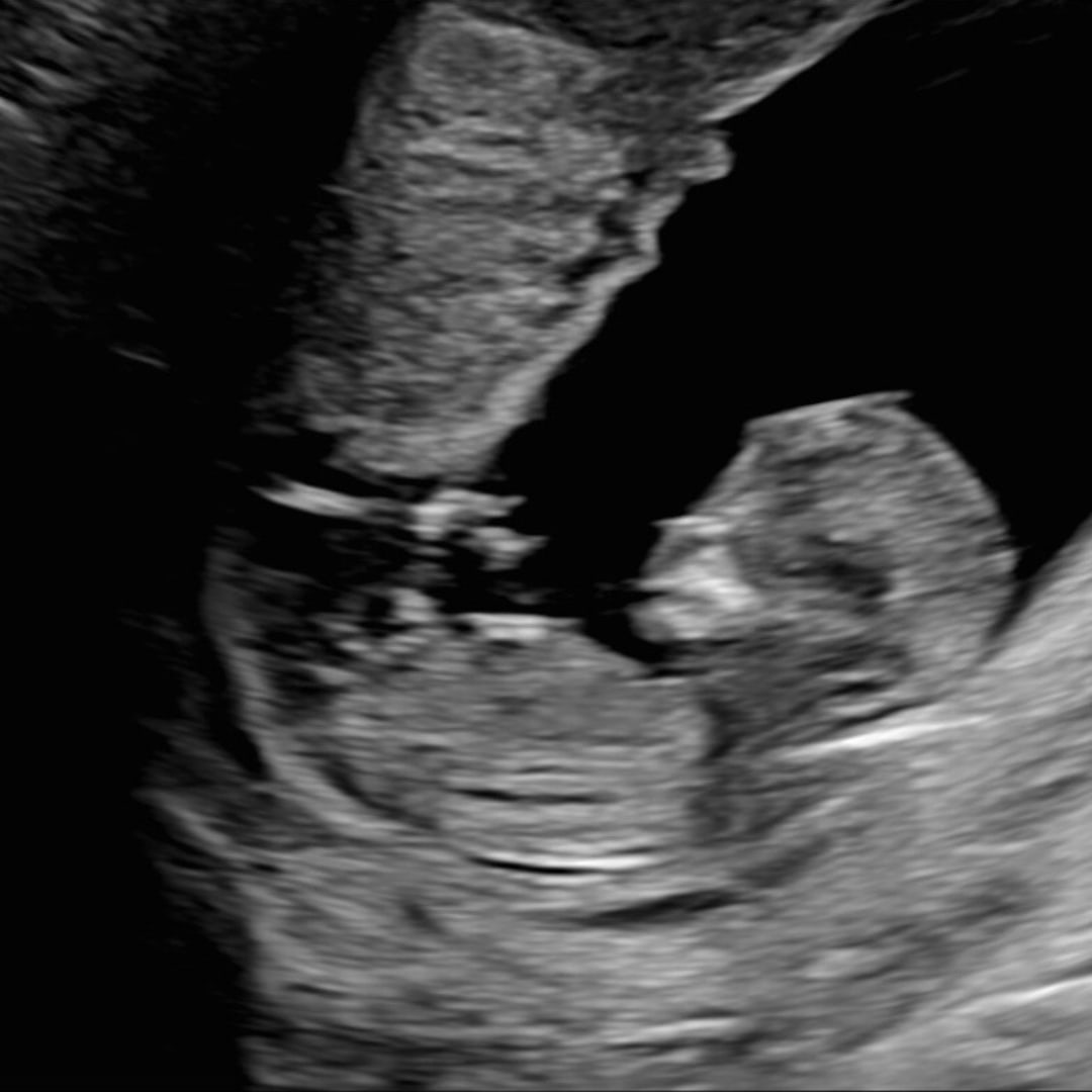 Photo shared by Catarina for their Babylist baby registry.