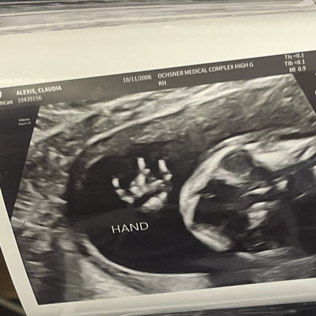 Photo shared by Claudia for their Babylist baby registry.