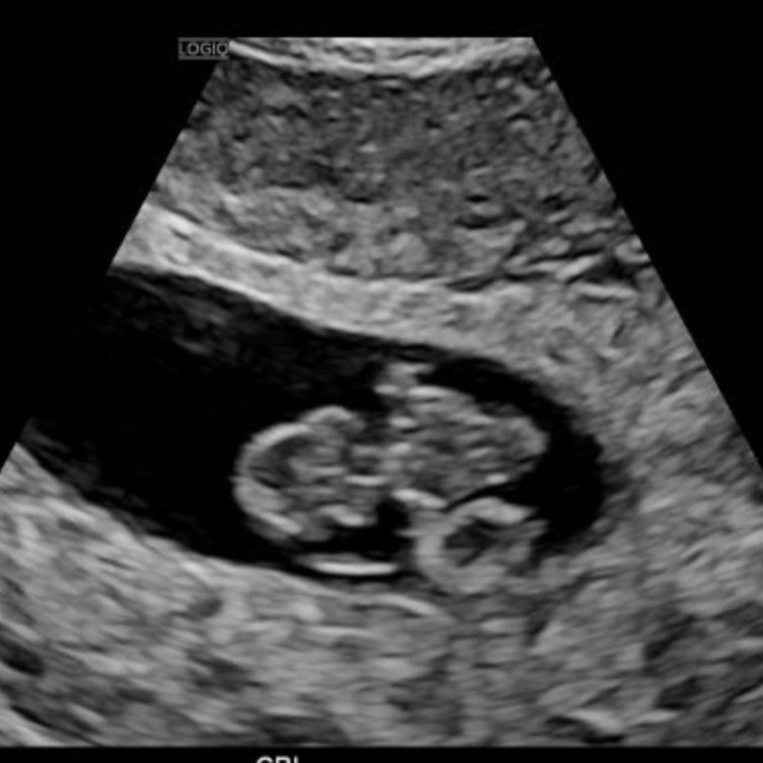 Photo shared by Mayra for their Babylist baby registry.
