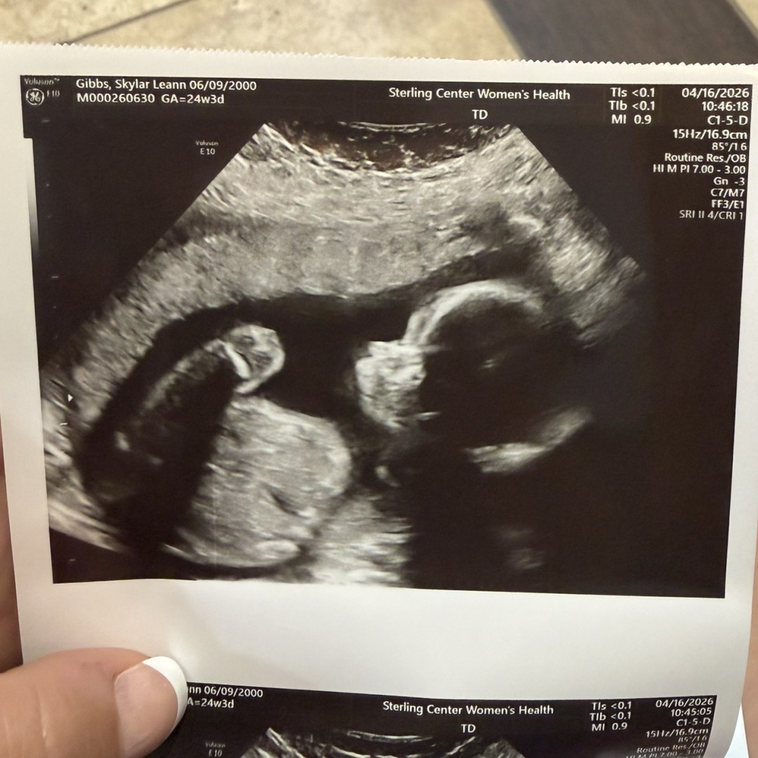 Photo shared by Skylar for their Babylist baby registry.