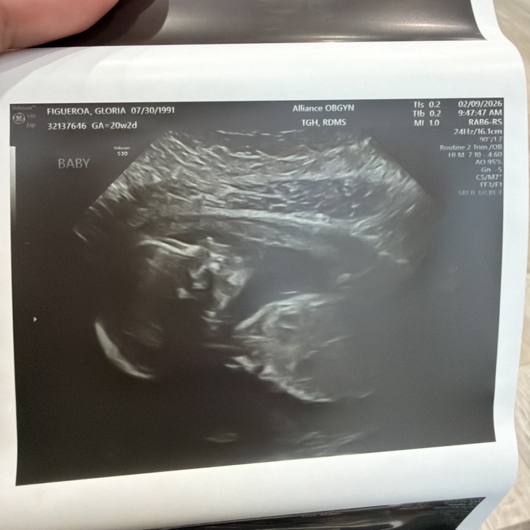 Photo shared by Gloria for their Babylist baby registry.