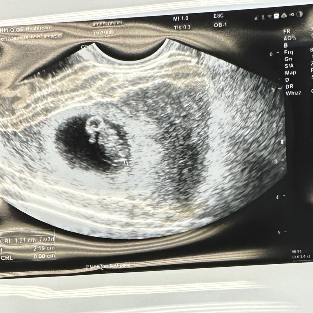 Photo shared by Rachel for their Babylist baby registry.