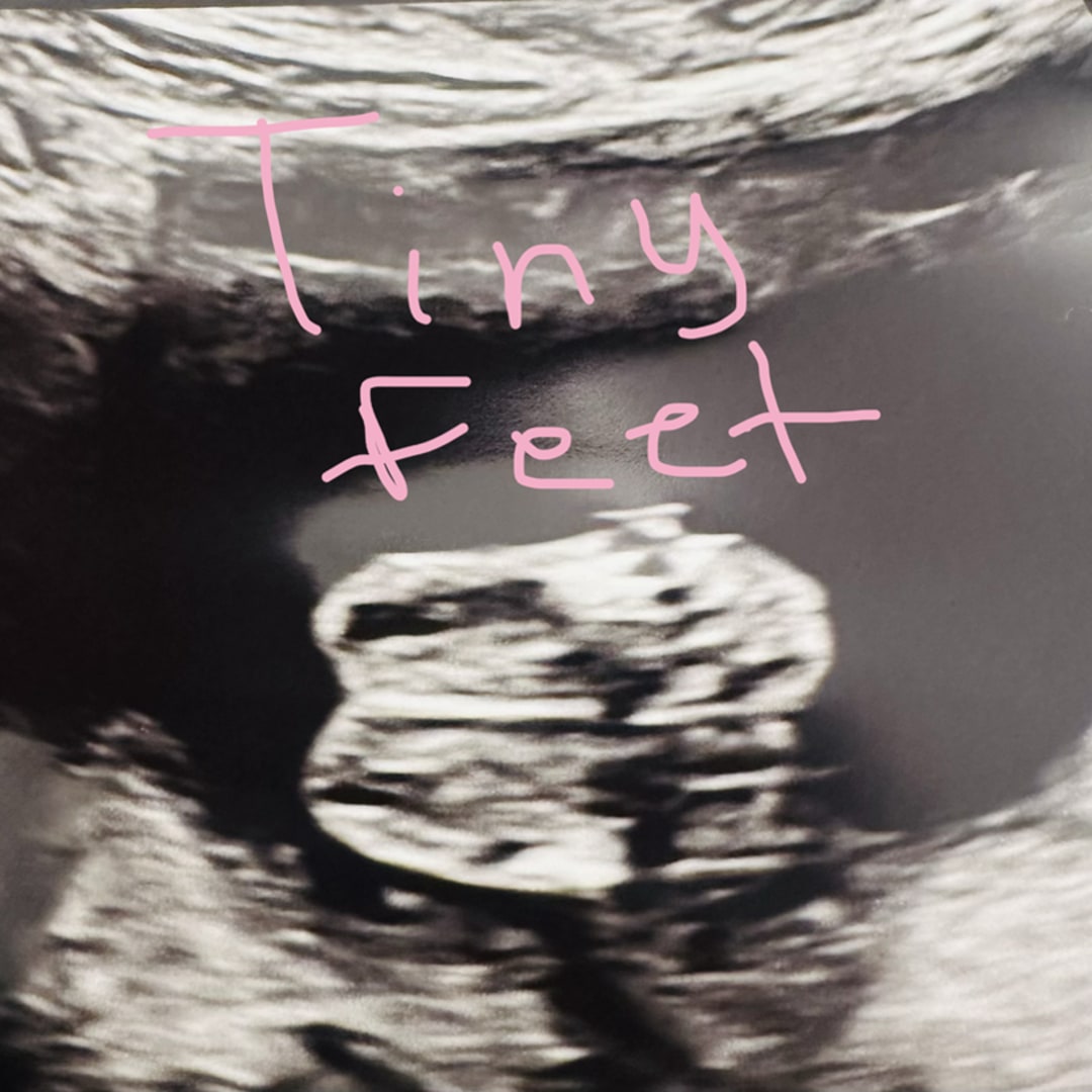 Photo shared by Janeece & Terry for their Babylist baby registry.