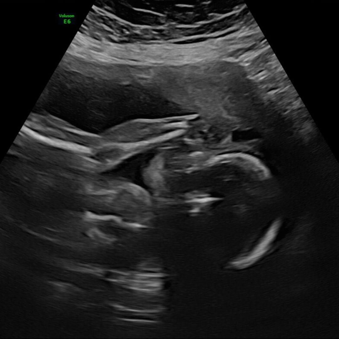 Photo shared by Bethany for their Babylist baby registry.