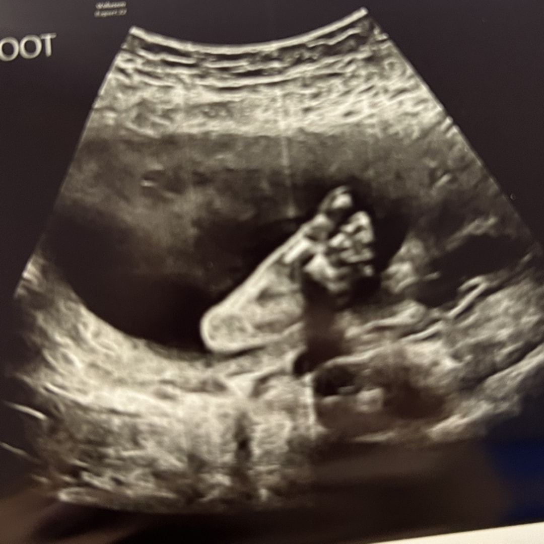 Photo shared by Christianna for their Babylist baby registry.