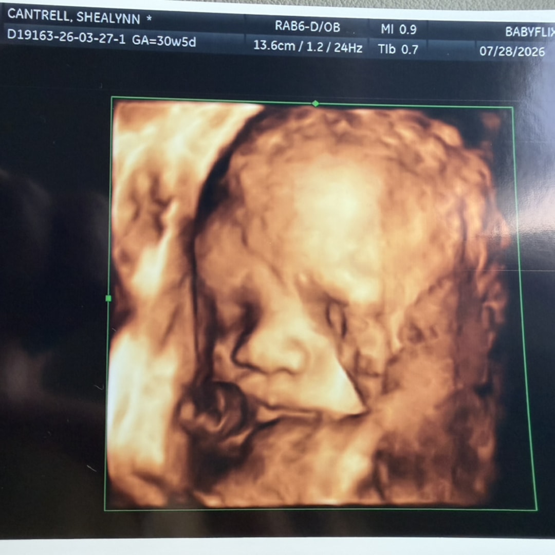 Photo shared by Shealynn for their Babylist baby registry.