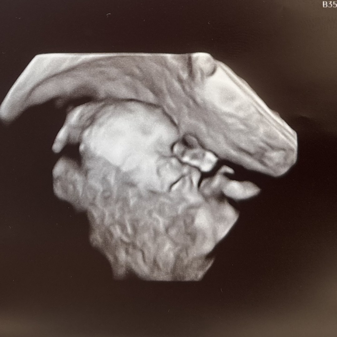 Photo shared by Arlene for their Babylist baby registry.