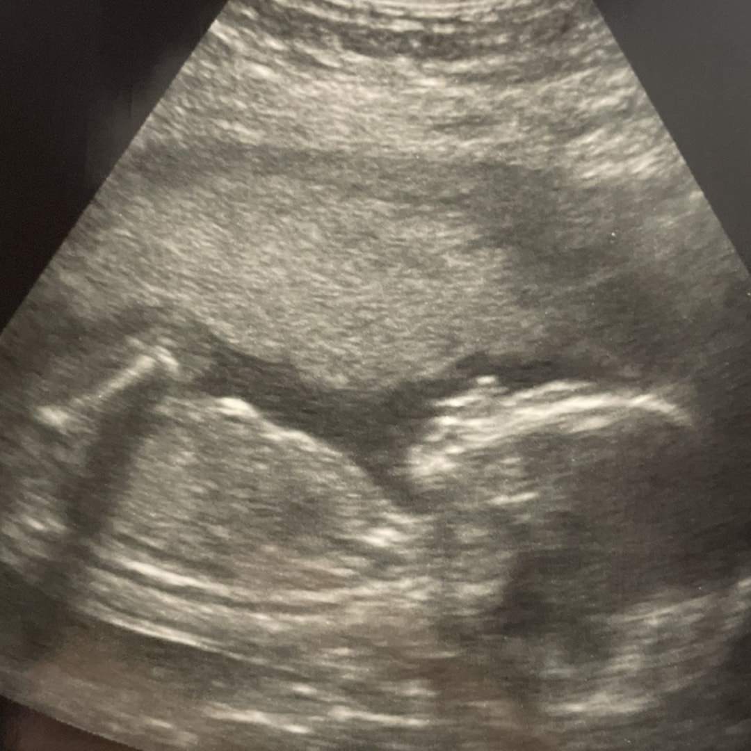 Photo shared by Vivian for their Babylist baby registry.
