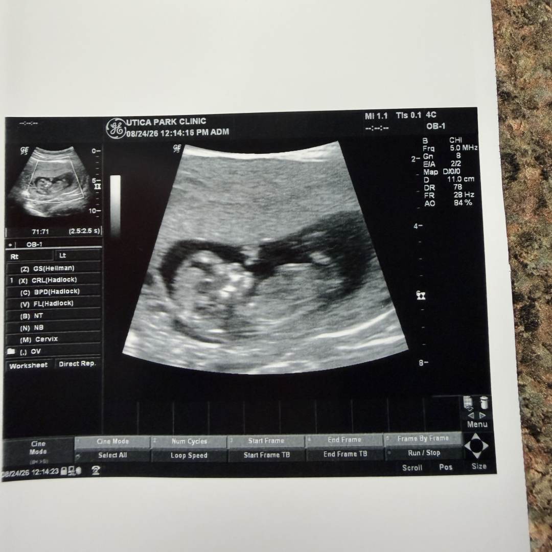 Photo shared by Tabby for their Babylist baby registry.