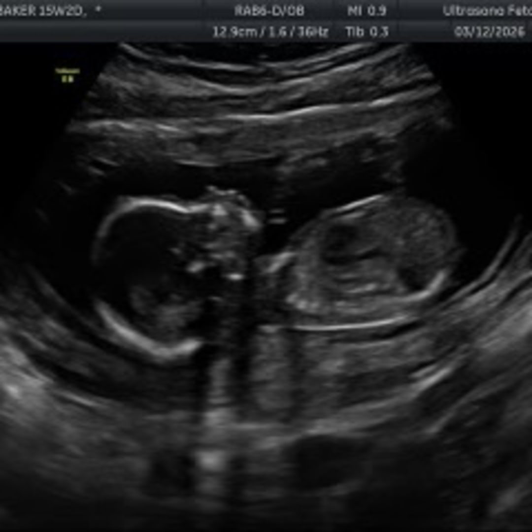 Photo shared by Ojanae for their Babylist baby registry.